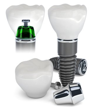 Dental Lux Total - clinica stomatologica